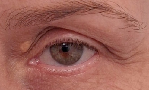 Kępka Żółta